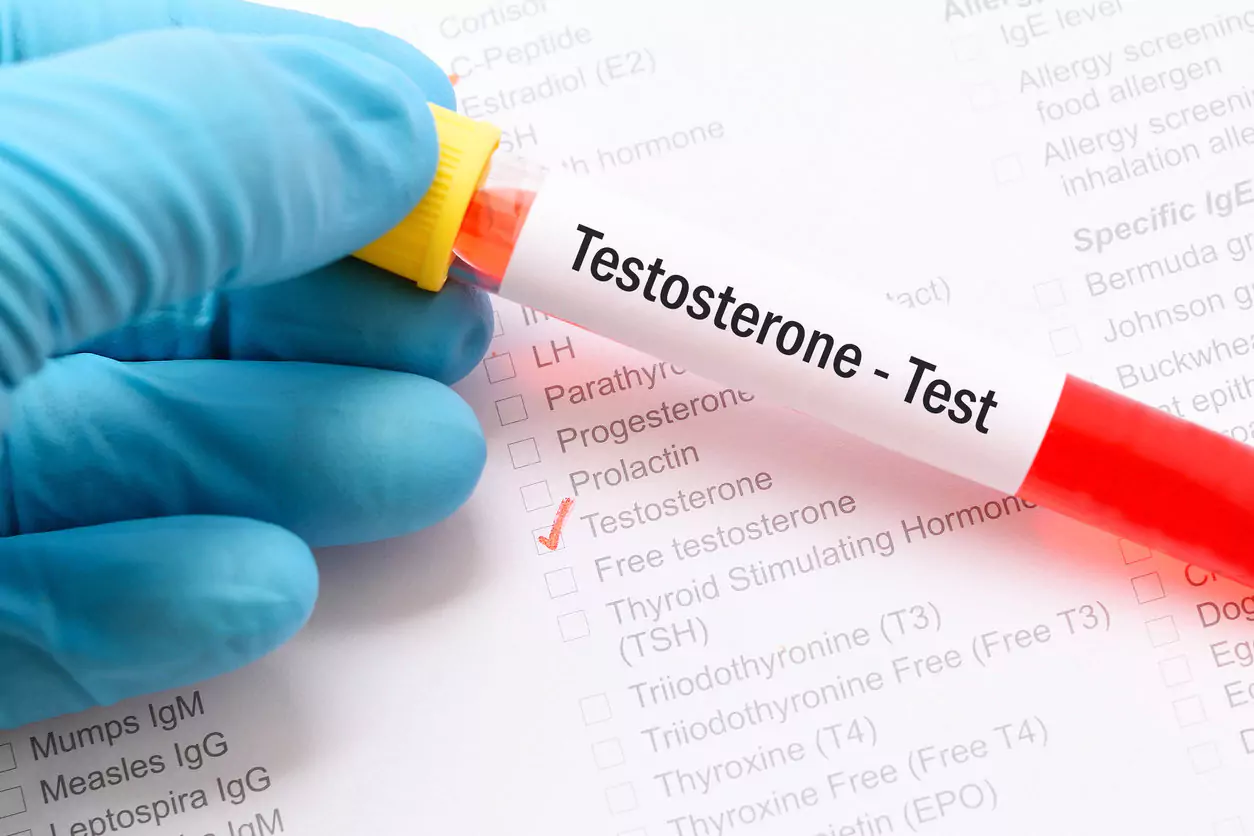 foods that lower testosterone