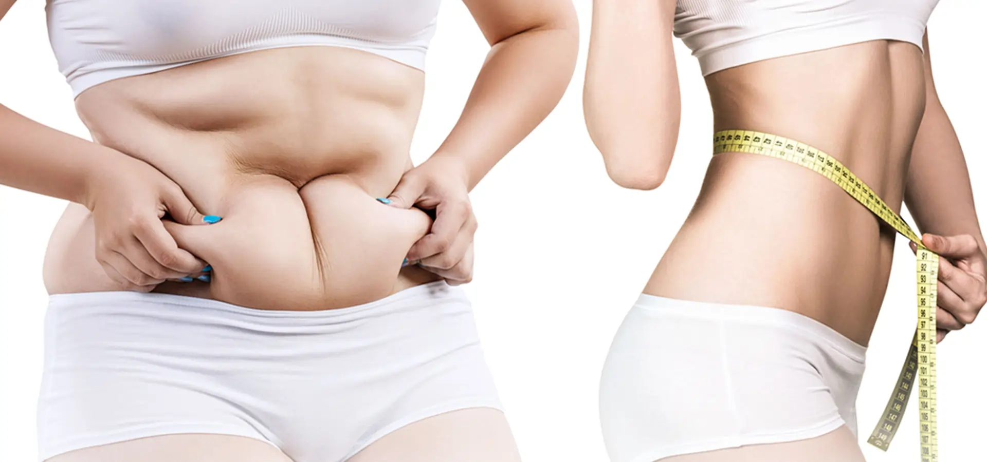 liposuction results