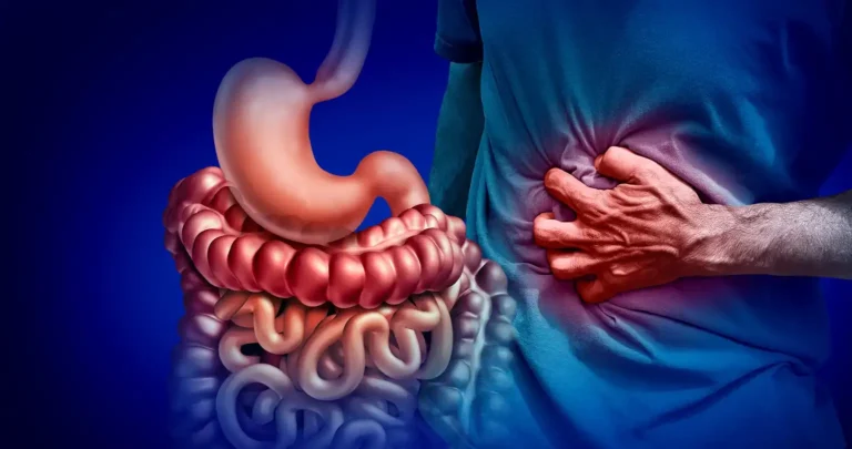 bowel cancer stomach noises​